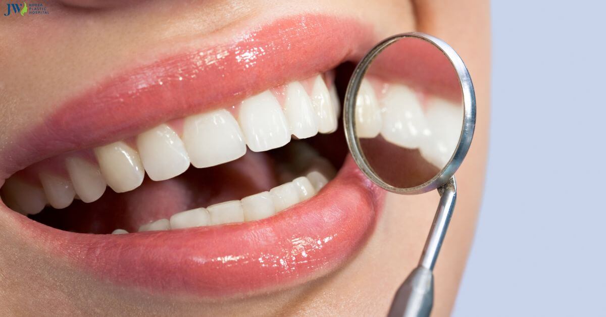 Răng sứ veneer có gây hại không? Thumb