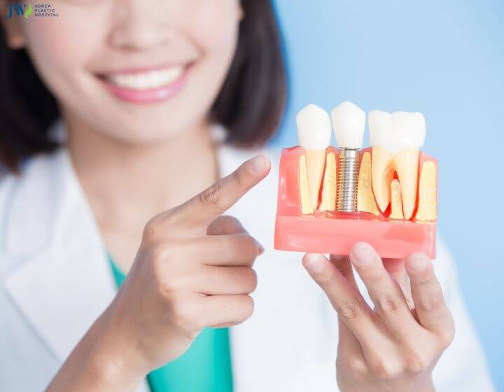 Trồng răng Implant có dùng bảo hiểm được không? 1