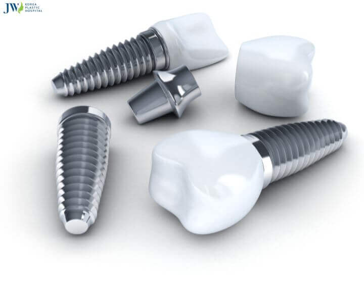 Cấy trụ implant có đau không? Có nên trồng răng implant không? 3