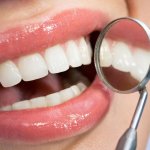 Cấy trụ implant có đau không? Có nên trồng răng implant không?