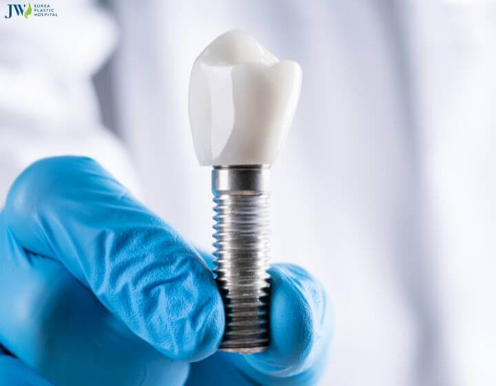 Trồng răng implant có an toàn không? Chăm sóc như thế nào? 1