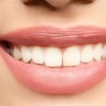 Trồng răng implant có an toàn không? Chăm sóc như thế nào?