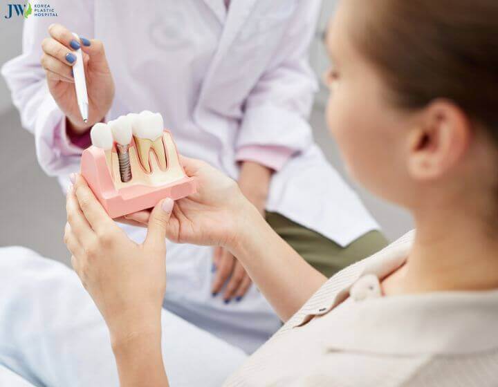Trồng răng implant có bền như quảng cáo không? 2