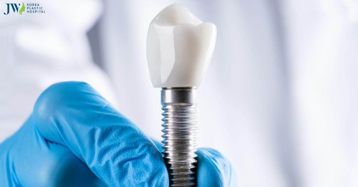 Trồng răng implant có bền như quảng cáo không? Thumb