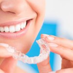 Niềng răng trong suốt AI điều trị răng hô hàm trên có hiệu quả không?