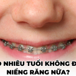 [ Giải đáp ] Bao nhiêu tuổi không được niềng răng nữa?
