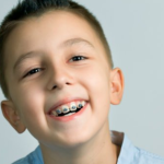 Lợi ích và rủi ro của việc niềng răng cho trẻ 9 tuổi