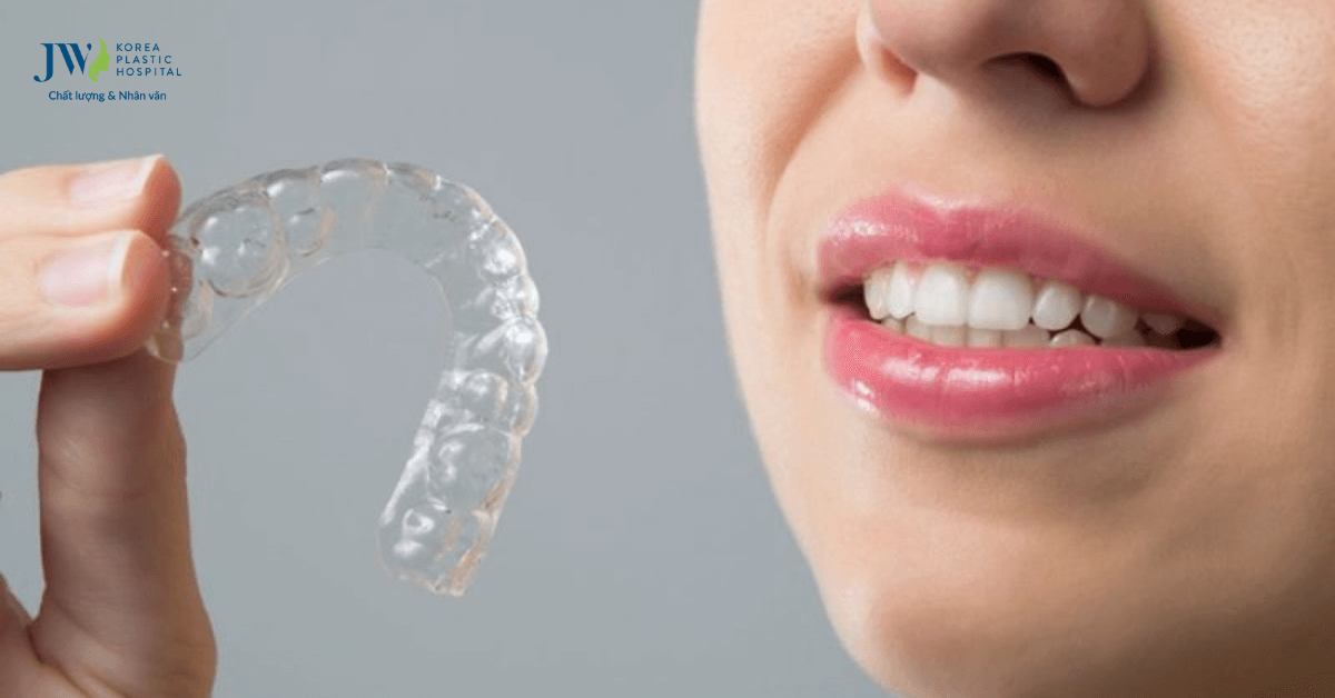 quy trình niềng răng trong suốt