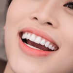 Bọc răng sứ: Khái niệm, phân loại, chi phí