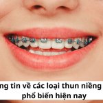 Thông tin về các loại thun niềng răng phổ biến hiện nay