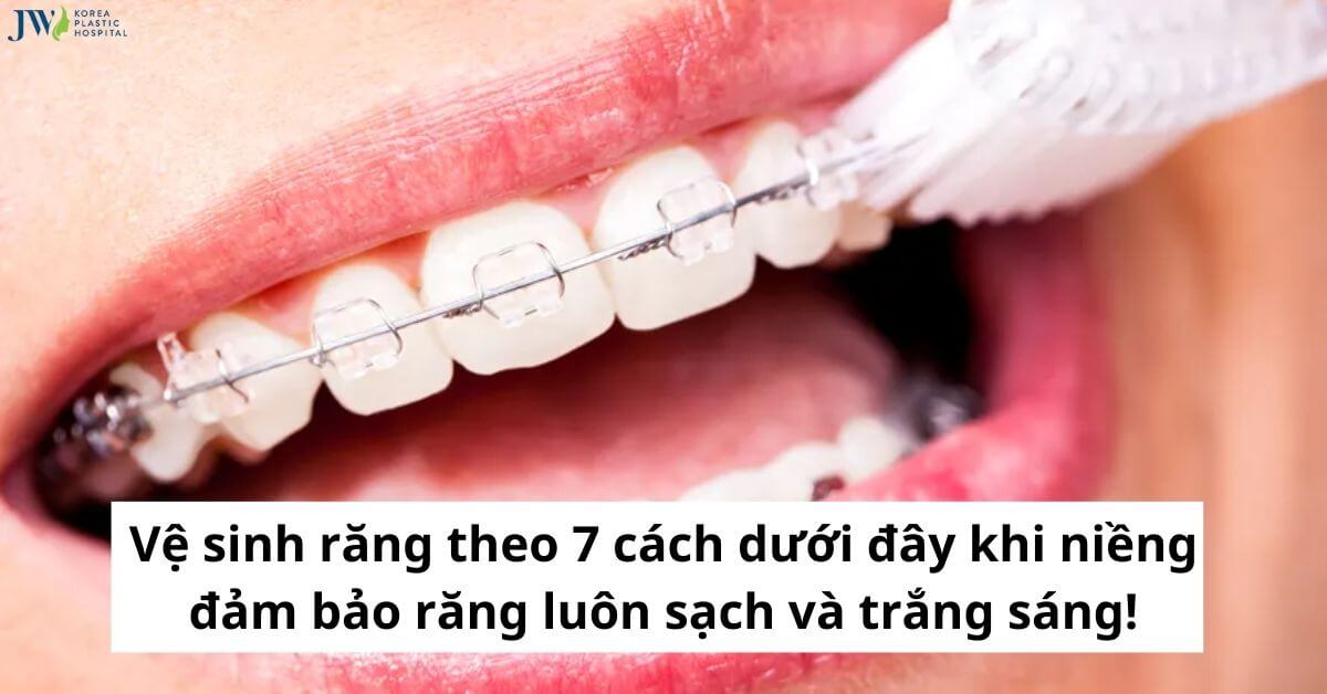 Vệ sinh răng theo 7 cách dưới đây khi niềng đảm bảo răng luôn sạch và trắng sáng! thumb