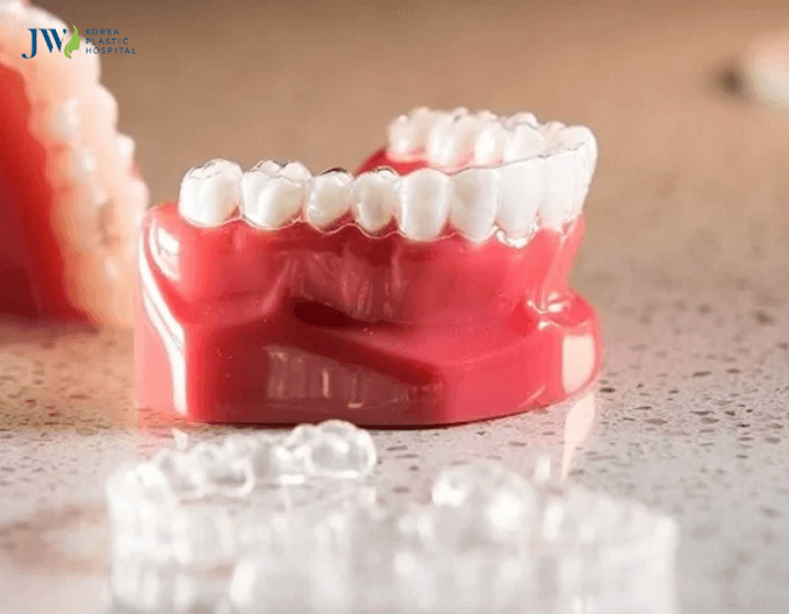 Niềng răng 3D Clear và niềng răng trong suốt AI