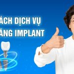 Chính sách dịch vụ trồng răng Implant tại Khoa Răng Hàm Mặt JW