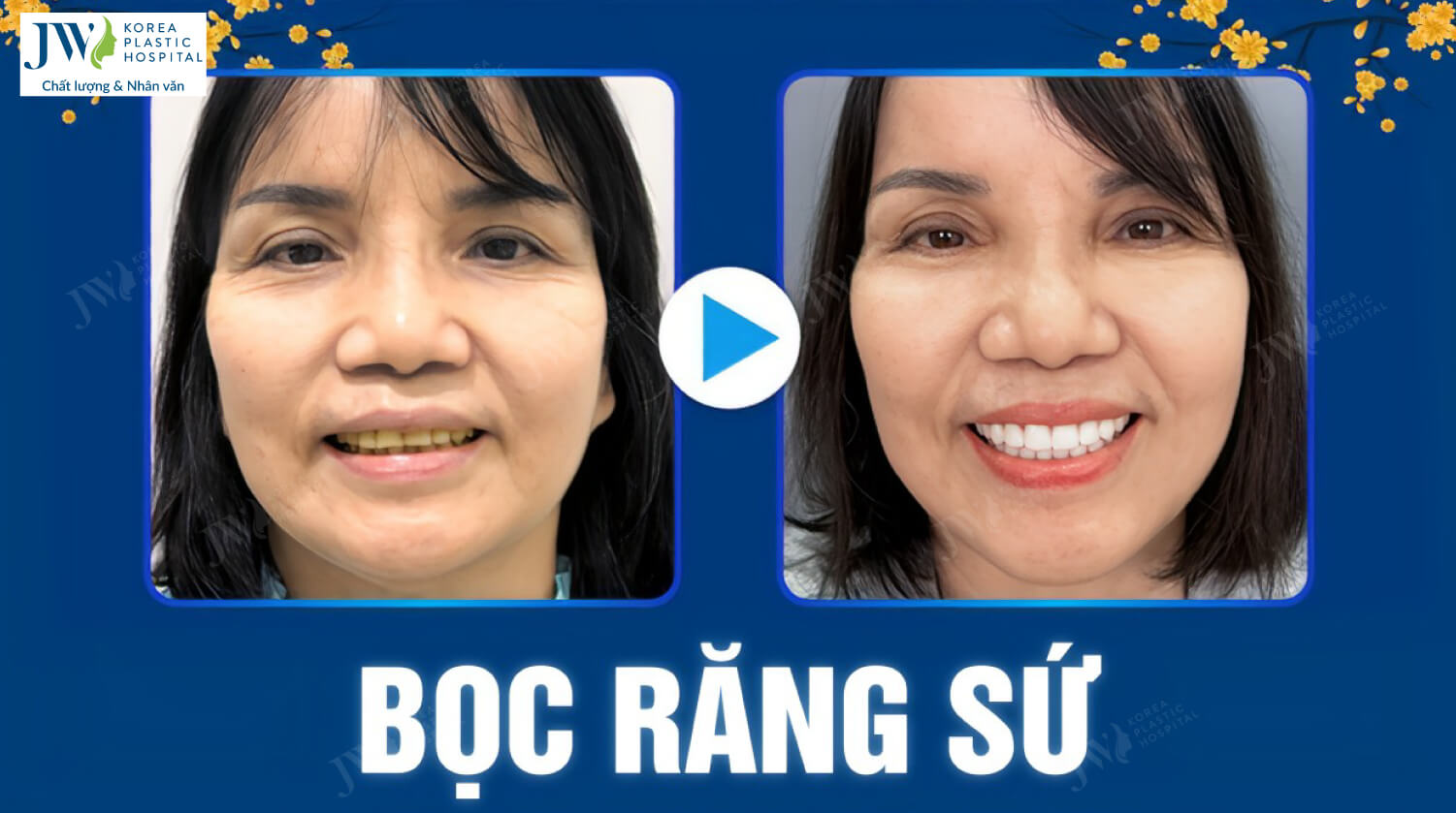 boc-rang-su