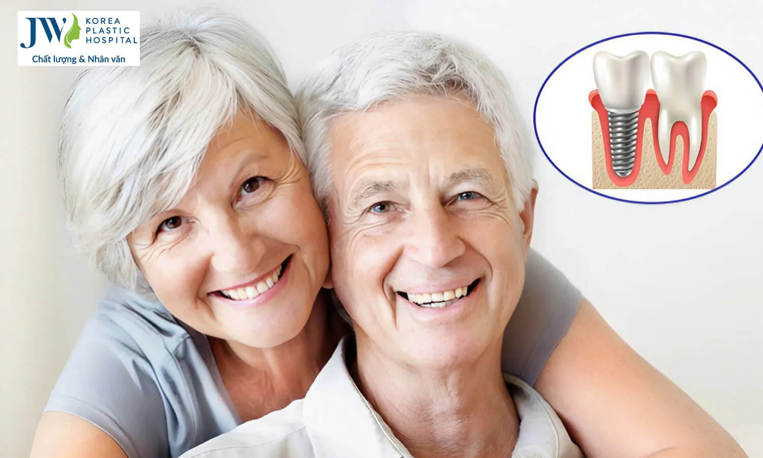 loi-ich-trong-rang-implant