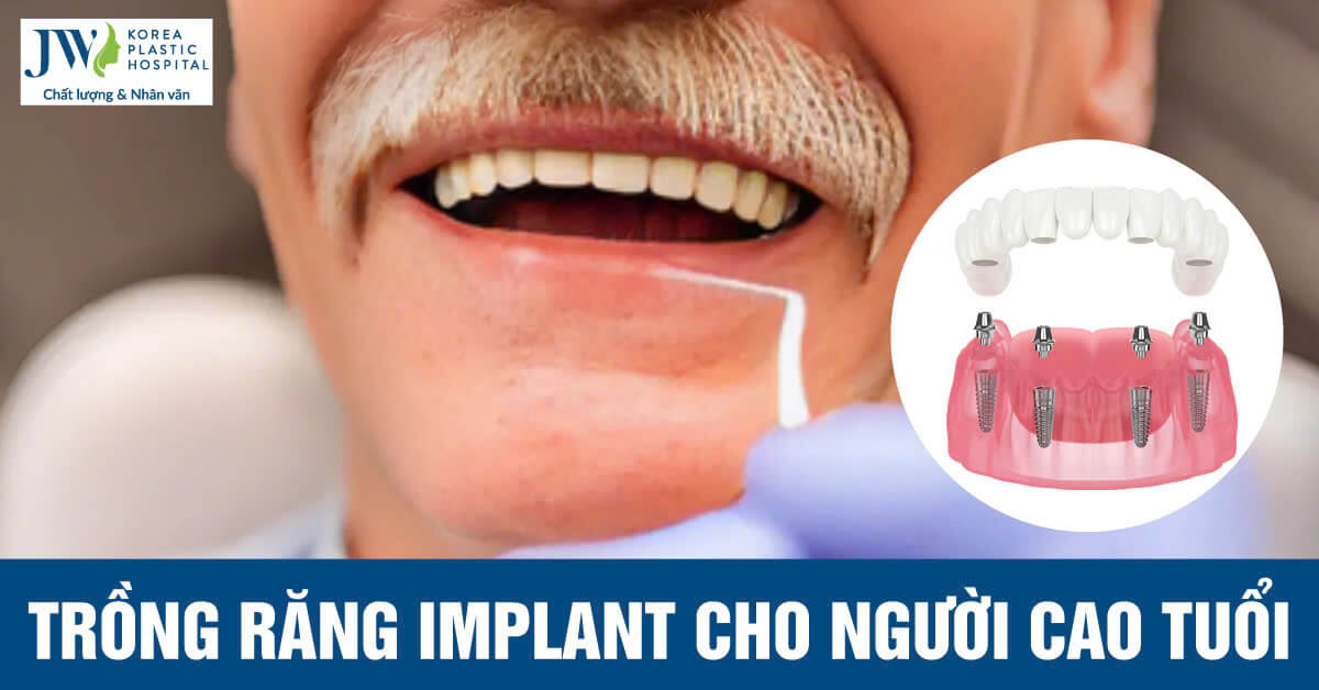 Trồng răng Implant tại Bệnh viện JW giúp ăn ngon, sống khỏe