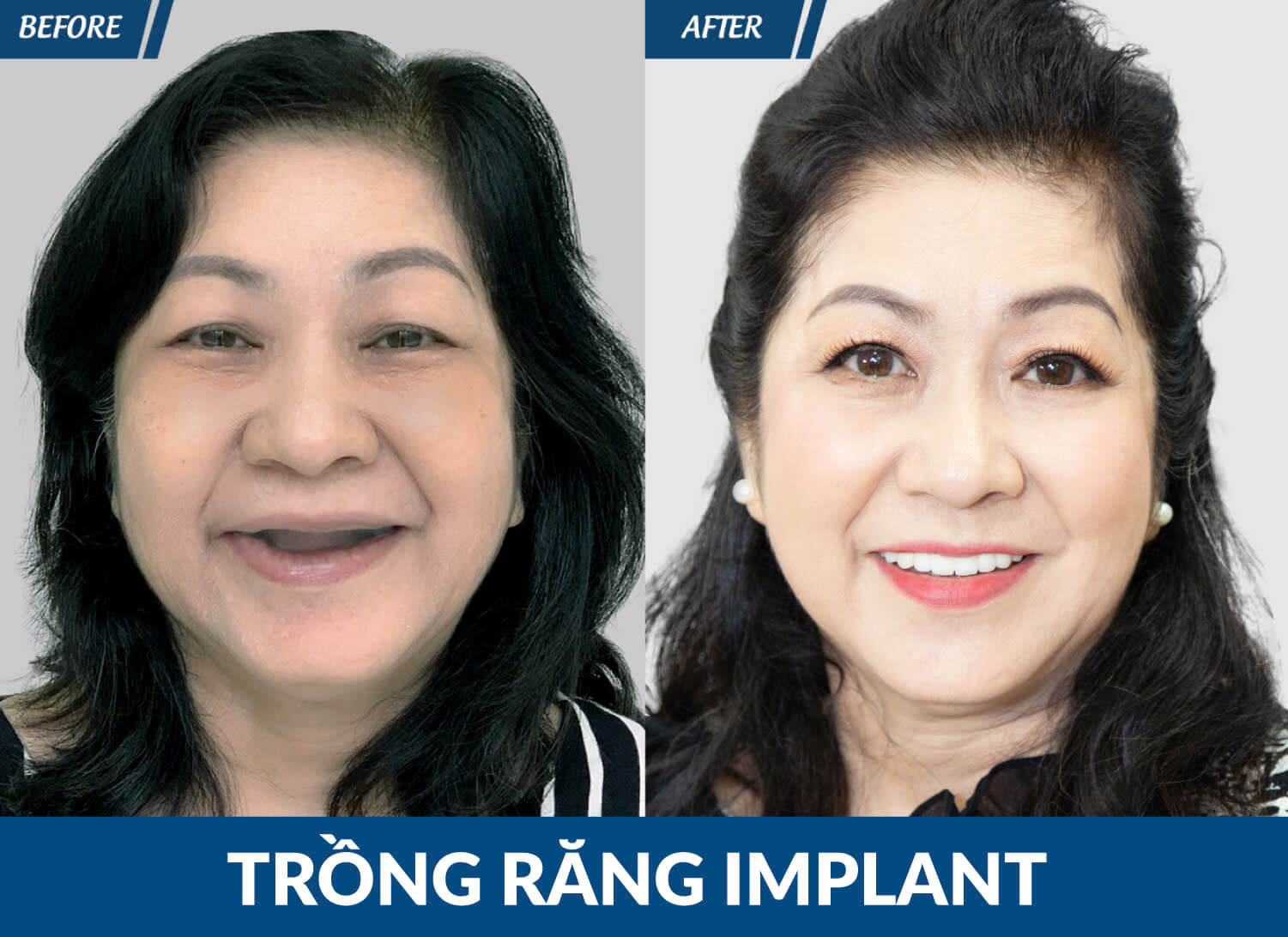 trong-rang-jw